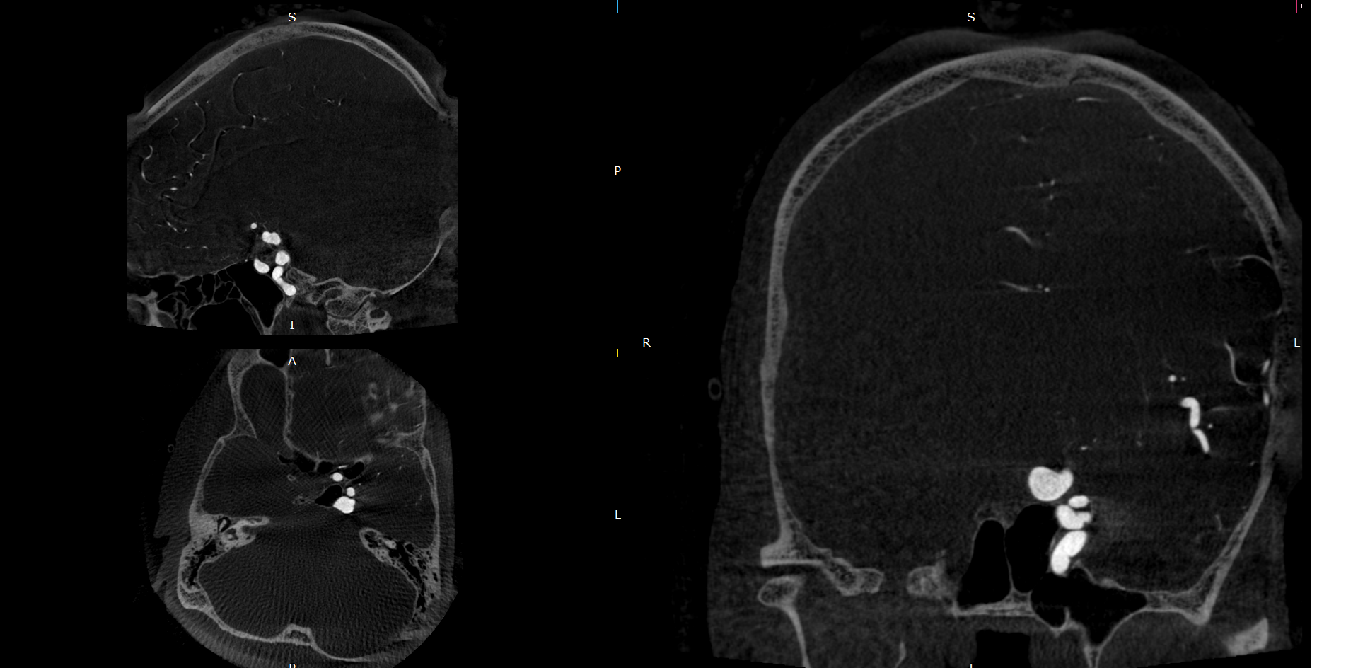 Neurovascular Model - New Request