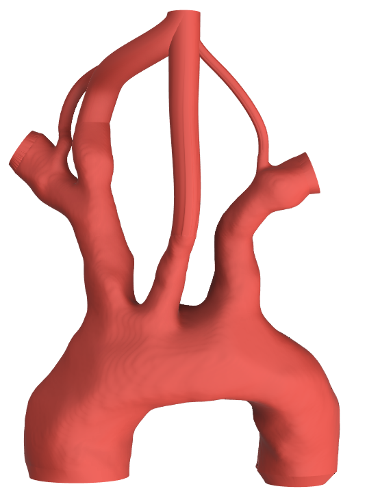 Aortic Training Arch Type 1