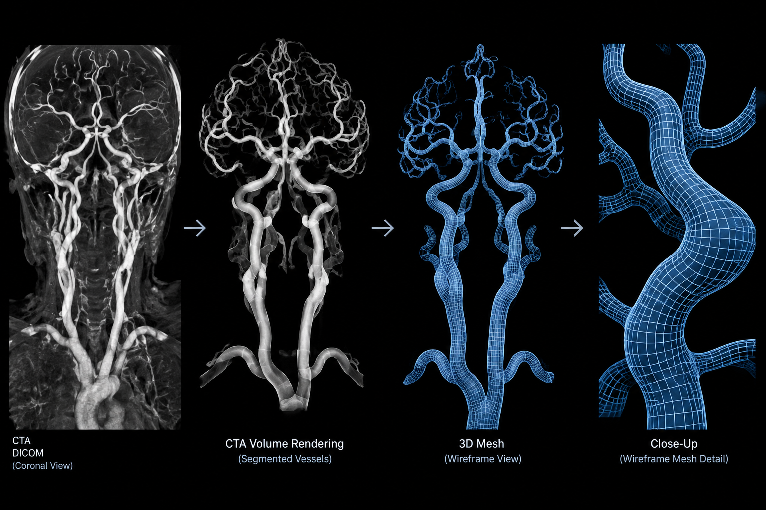 Anatomical Segmentation