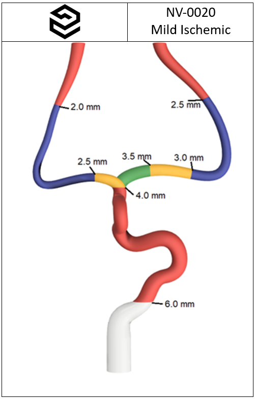 NV-0020 RICE Mild Ischemic