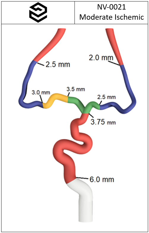 NV-0021 RICE Moderate Ischemic