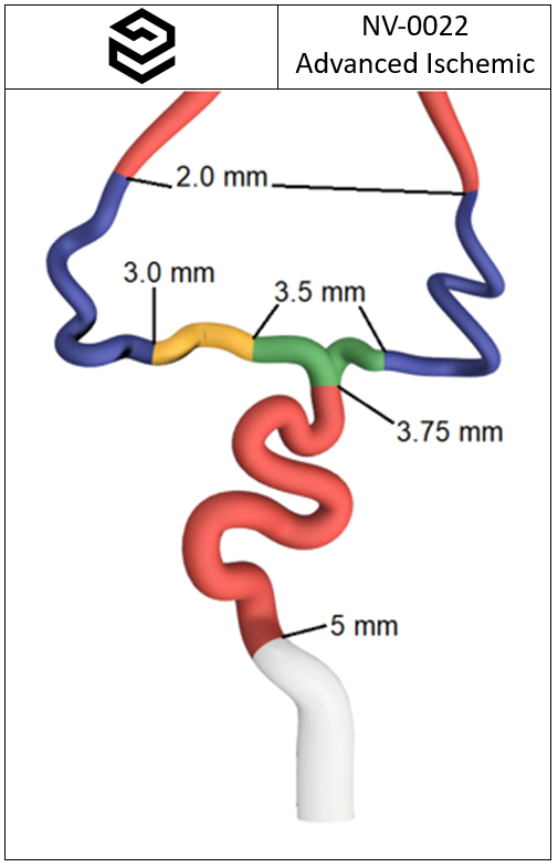 NV-0022 RICE Advanced Ischemic