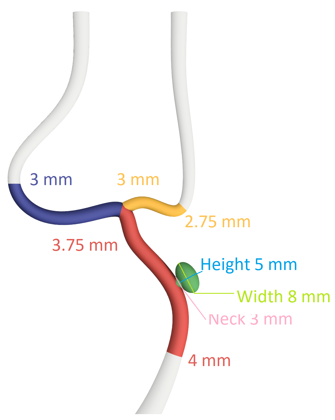 NV-0034 Basic Aneurysm Module