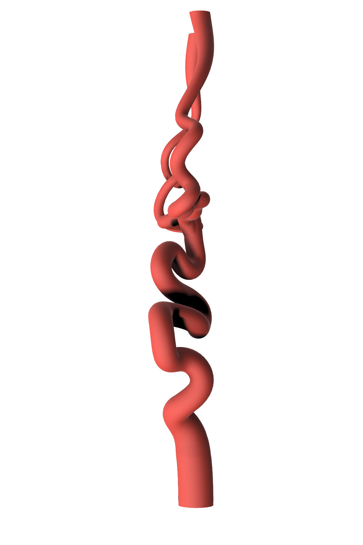 NV-0022 RICE Advanced Ischemic