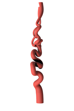 NV-0022 RICE Advanced Ischemic