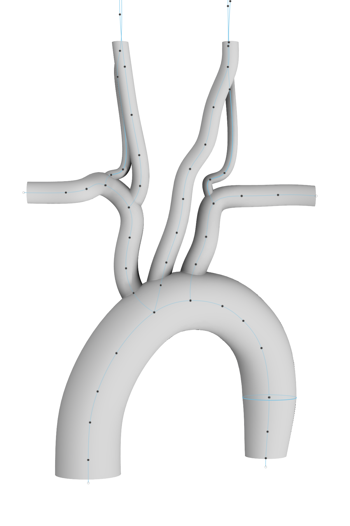 New Aortic Arch Request