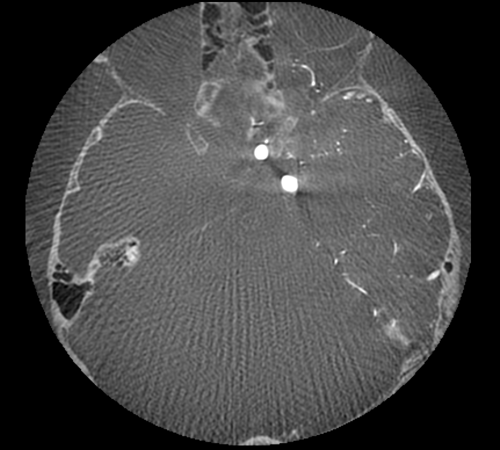 Neurovascular Model - New Request