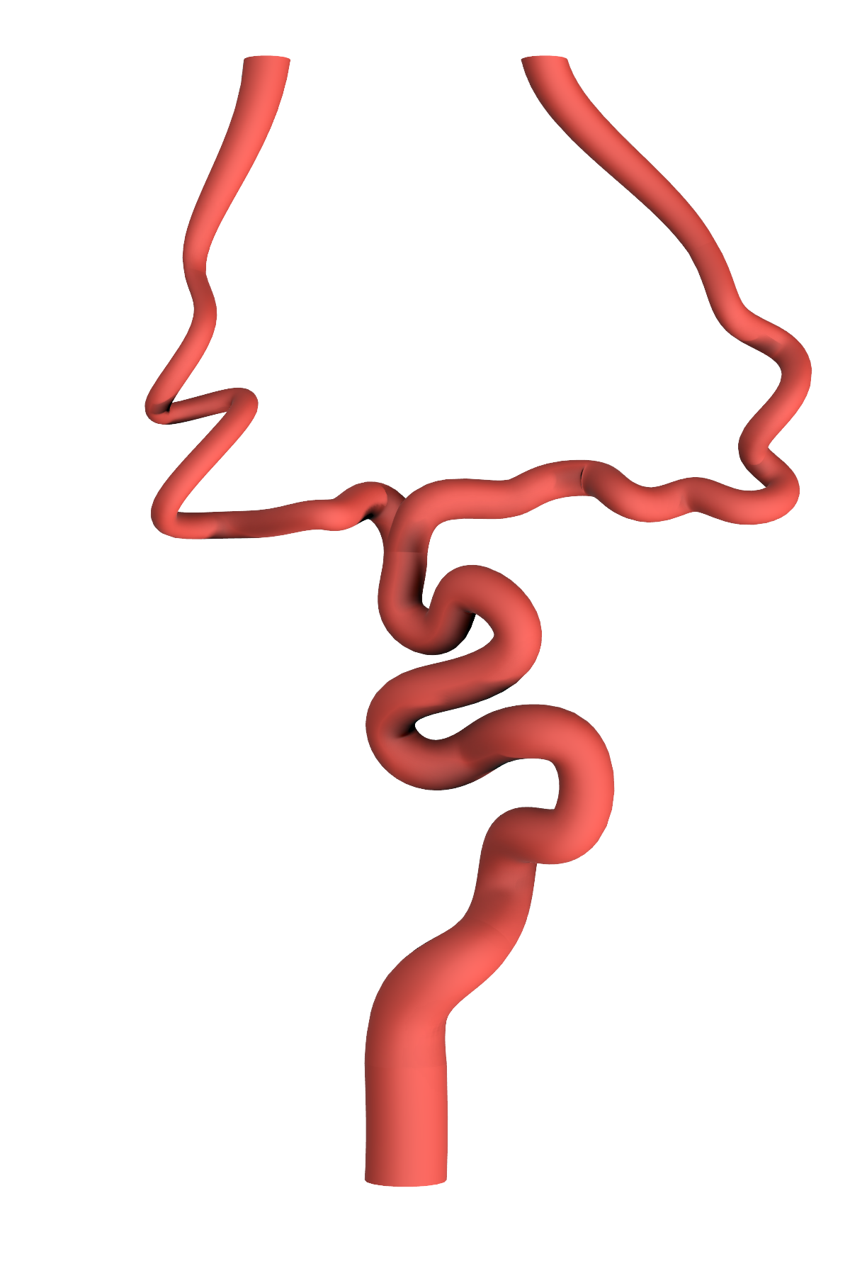 NV-0022 RICE Advanced Ischemic