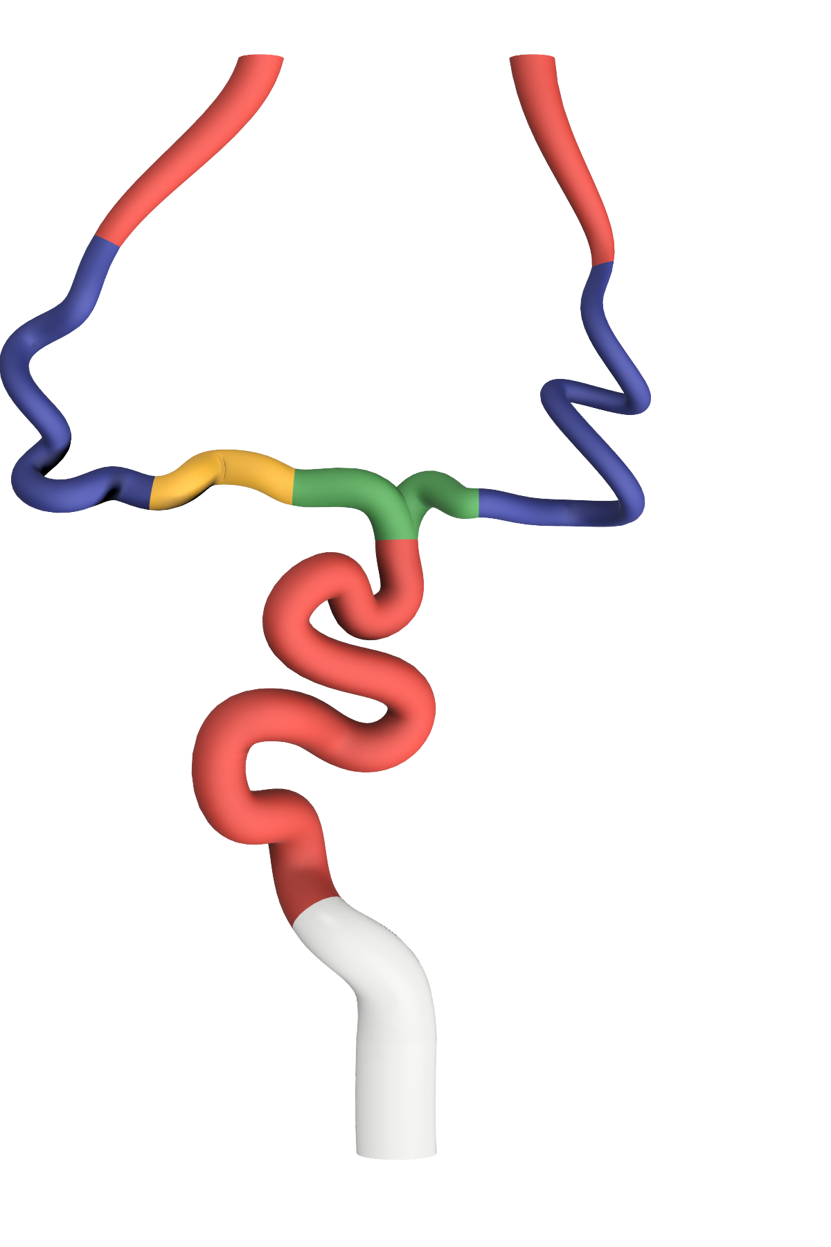 NV-0022 Advanced Ischemic