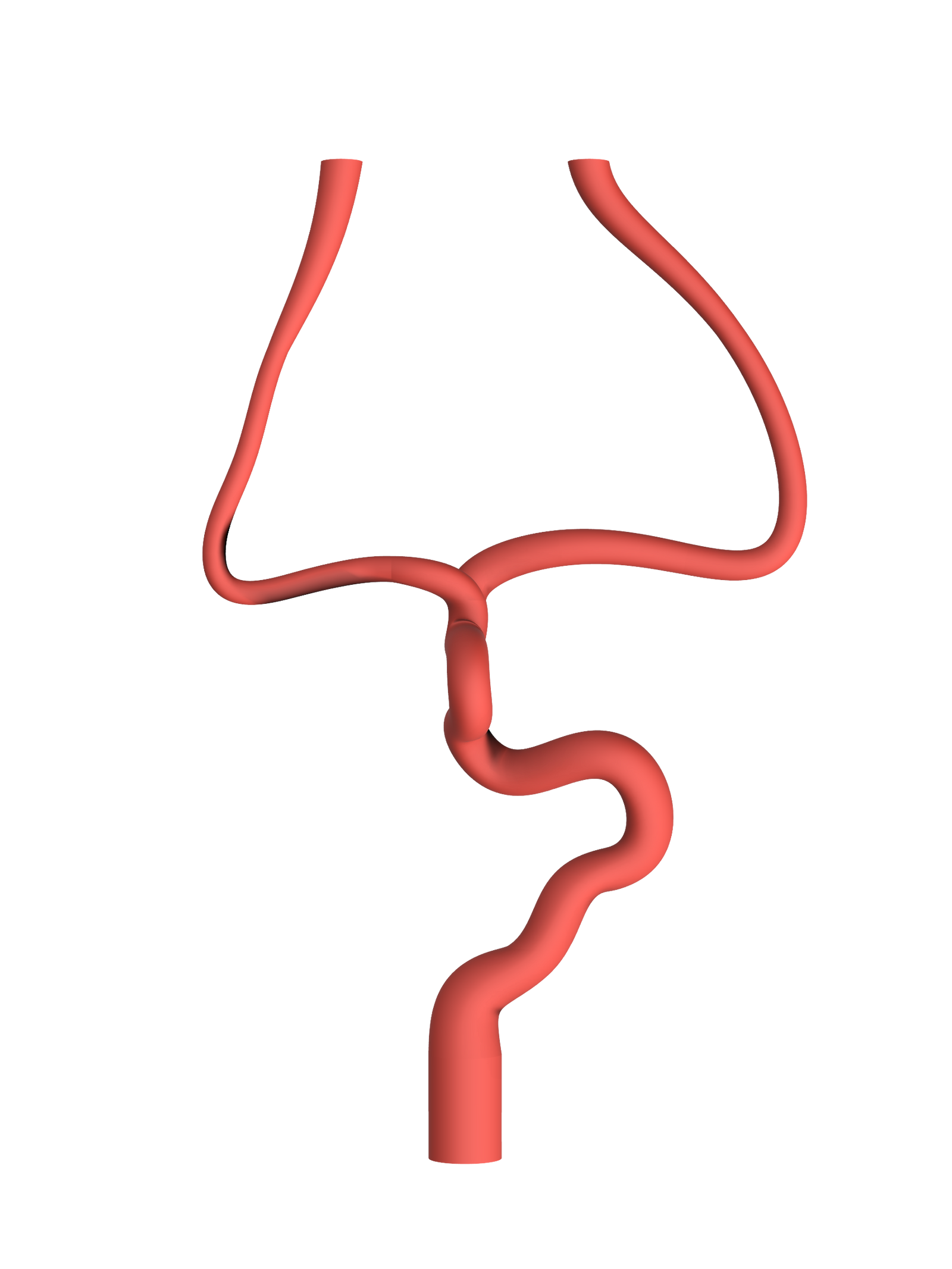 NV-0020 Mild Ischemic