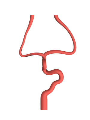 NV-0020 RICE Mild Ischemic