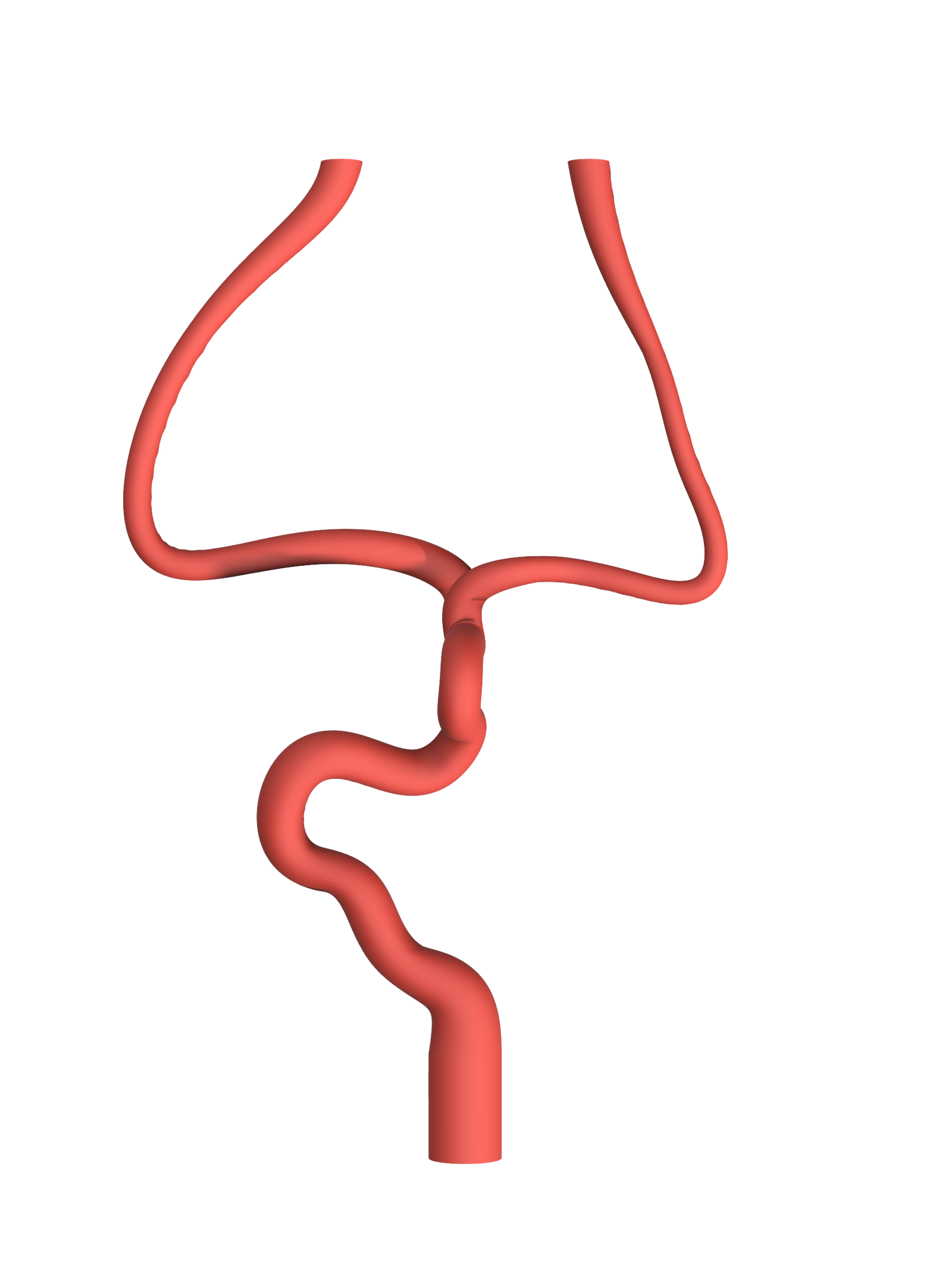 NV-0020 Mild Ischemic