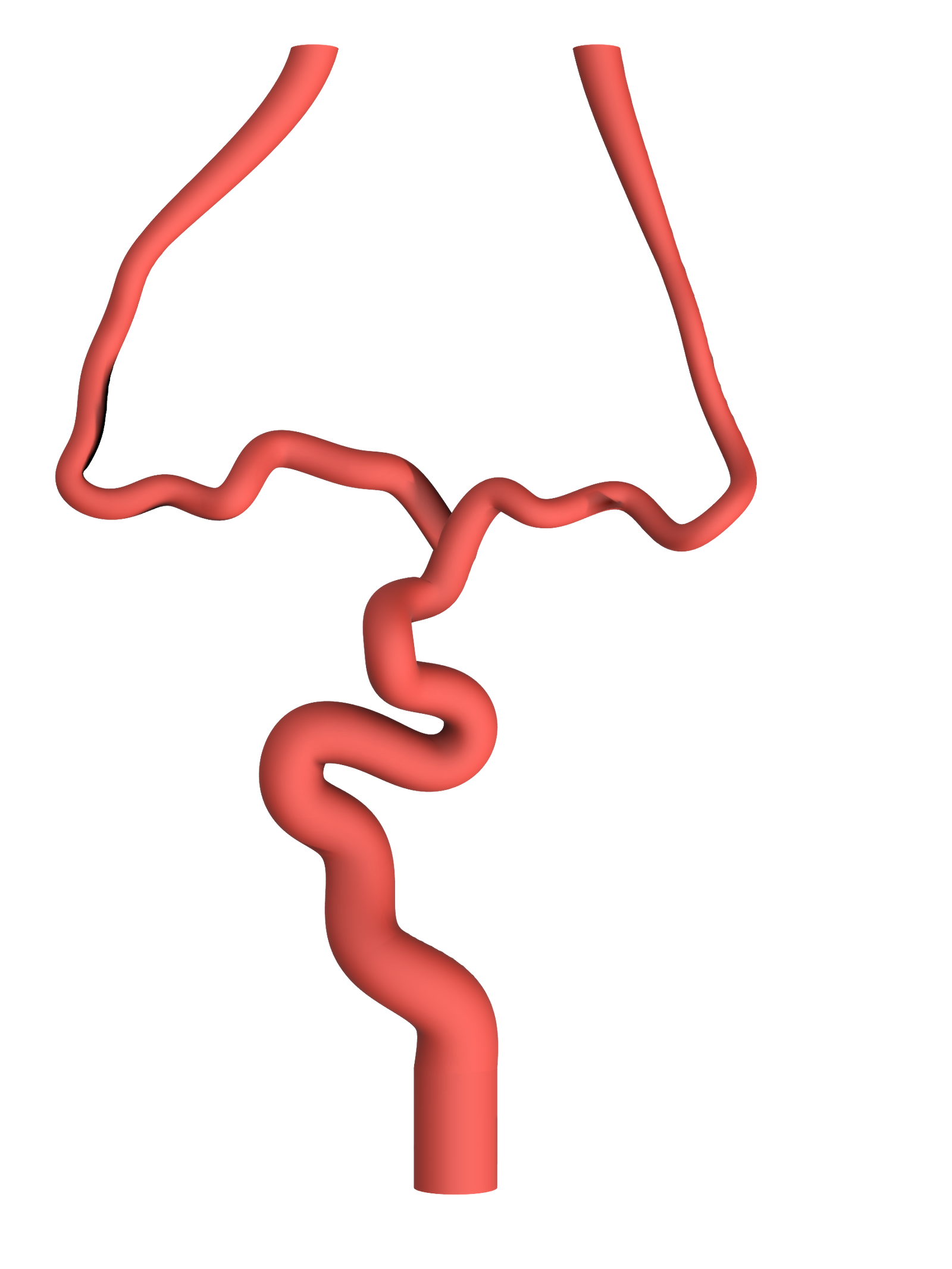 NV-0021 Moderate Ischemic