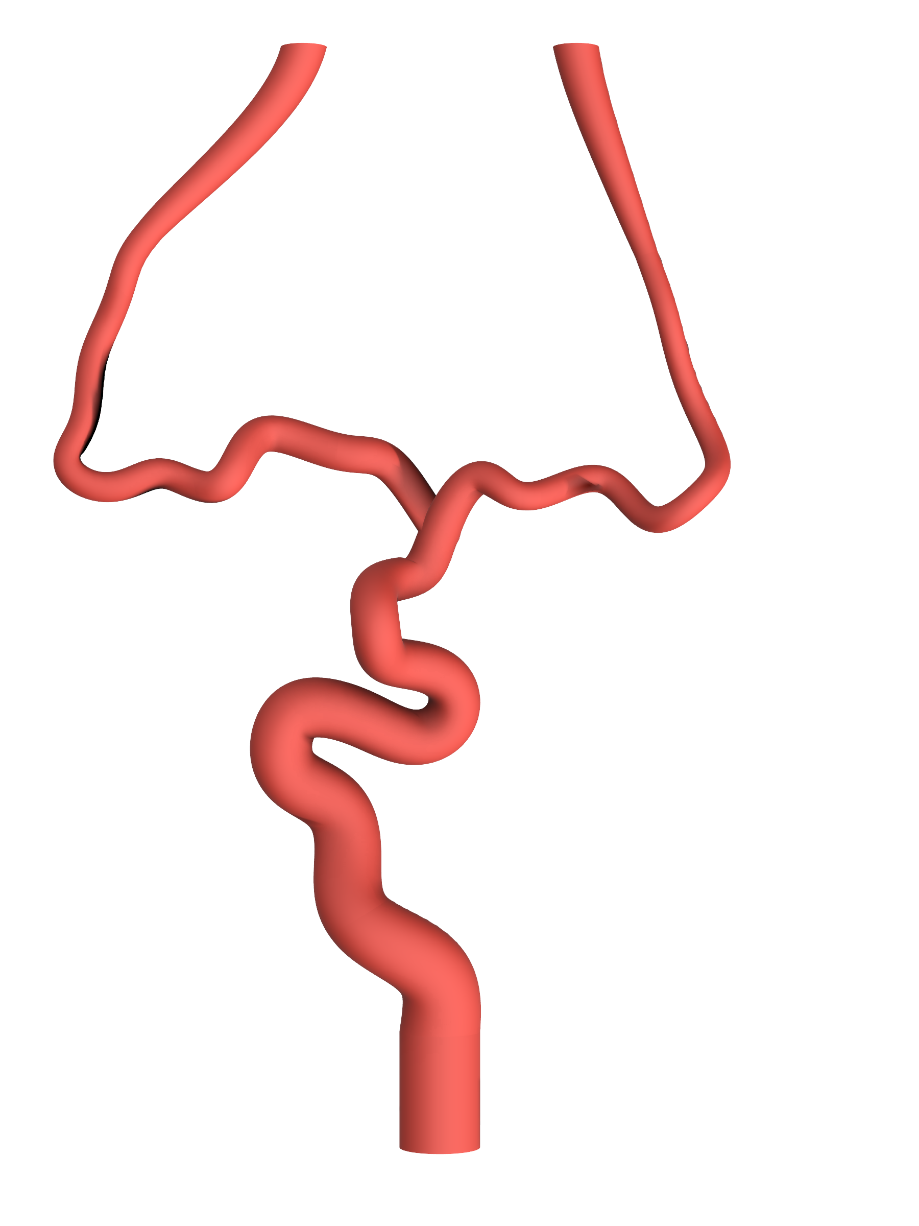 NV-0021 RICE Moderate Ischemic