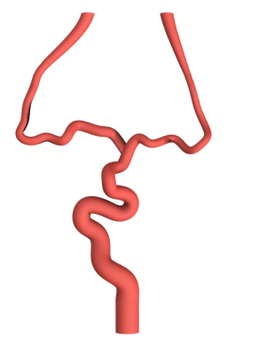 NV-0021 RICE Moderate Ischemic