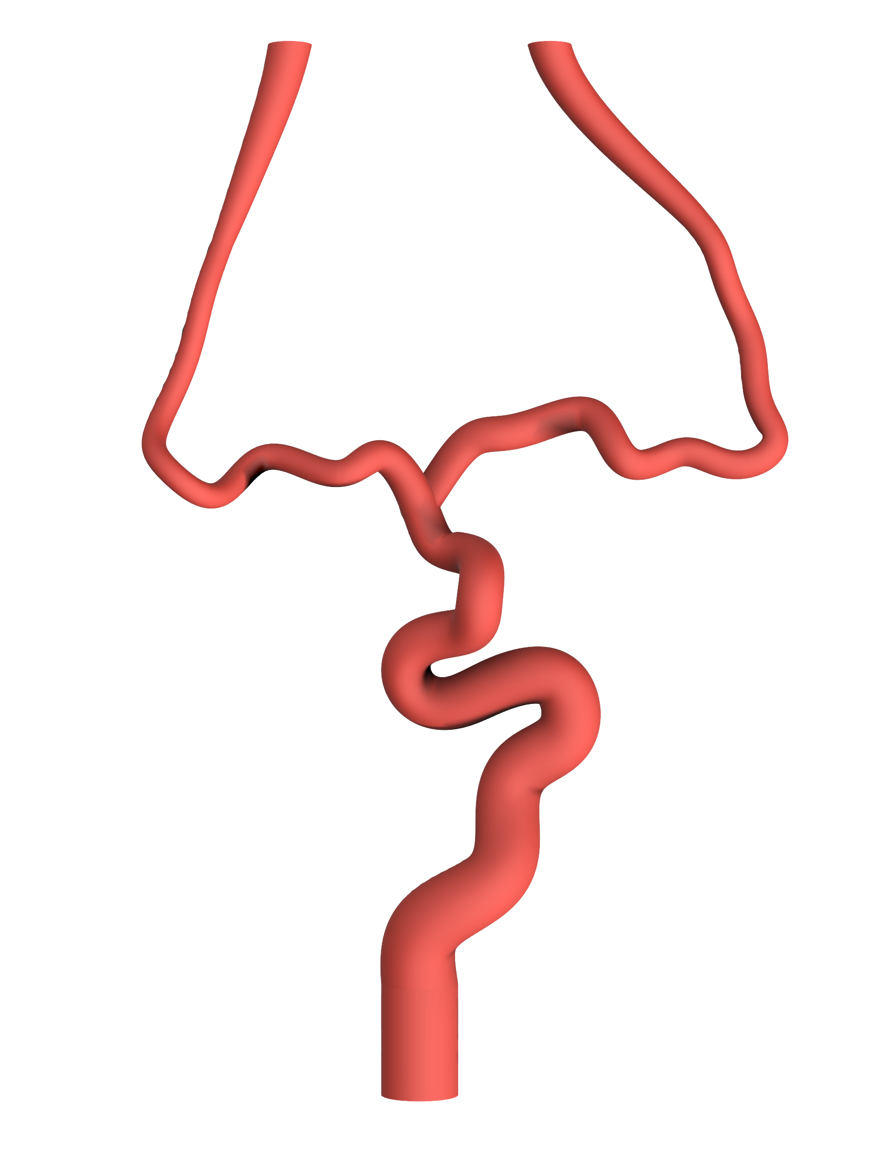 NV-0021 RICE Moderate Ischemic