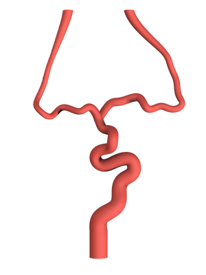 NV-0021 RICE Moderate Ischemic